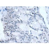 FSHB Antibody from Signalway Antibody (43940) - Antibodies.com