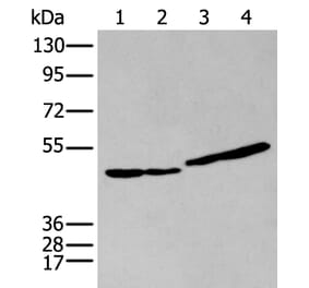 IL9R Antibody from Signalway Antibody (43947) - Antibodies.com