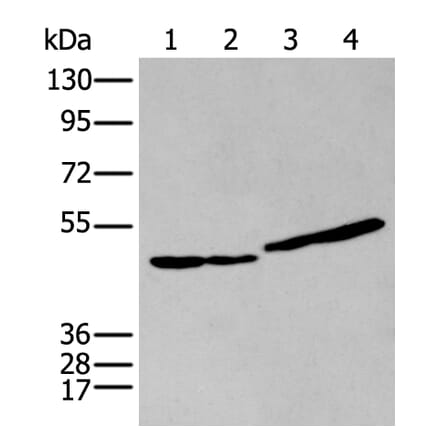 IL9R Antibody from Signalway Antibody (43947) - Antibodies.com