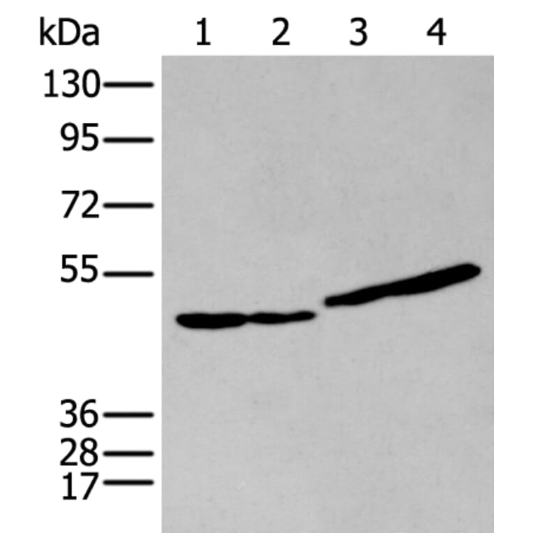 IL9R Antibody from Signalway Antibody (43947) - Antibodies.com