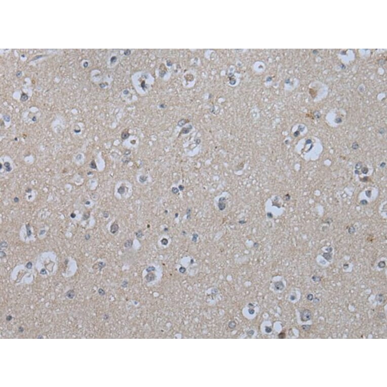 IL9R Antibody from Signalway Antibody (43947) - Antibodies.com