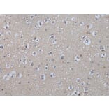 IL9R Antibody from Signalway Antibody (43947) - Antibodies.com