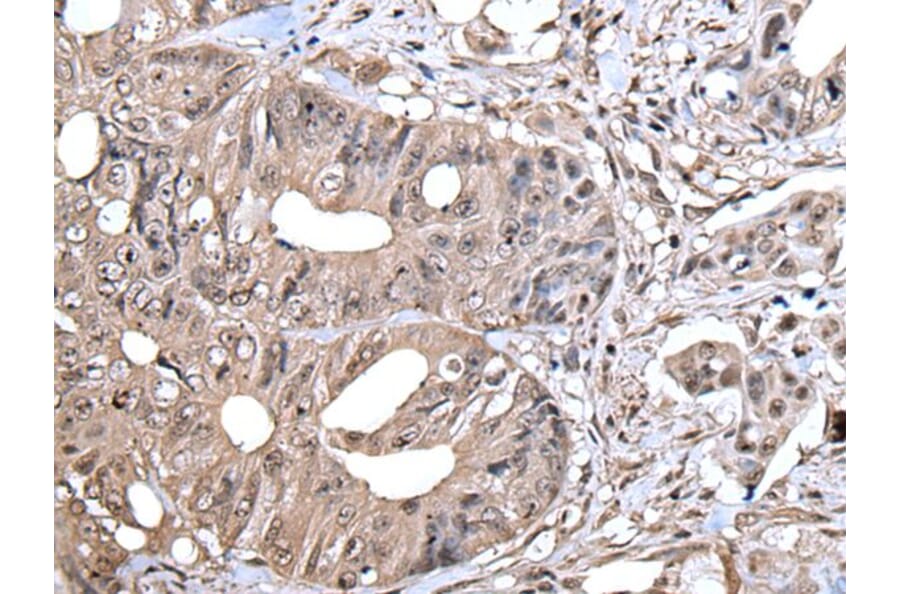 ZYX Antibody from Signalway Antibody (43893) - Antibodies.com