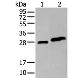 AK4 Antibody from Signalway Antibody (43922) - Antibodies.com