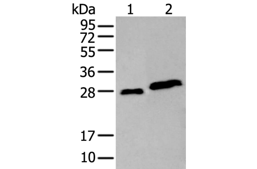 AK4 Antibody from Signalway Antibody (43922) - Antibodies.com