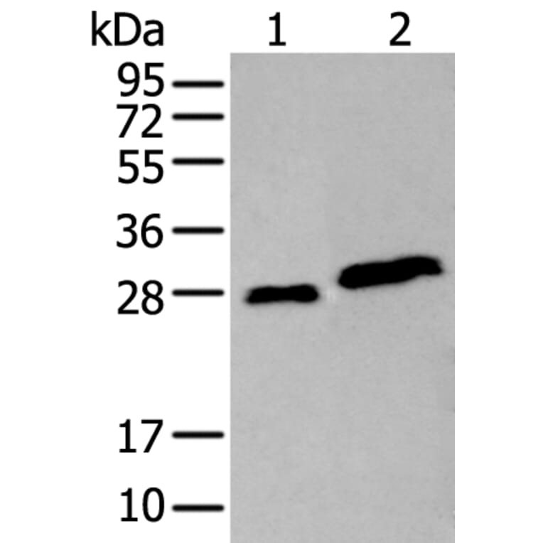 AK4 Antibody from Signalway Antibody (43922) - Antibodies.com