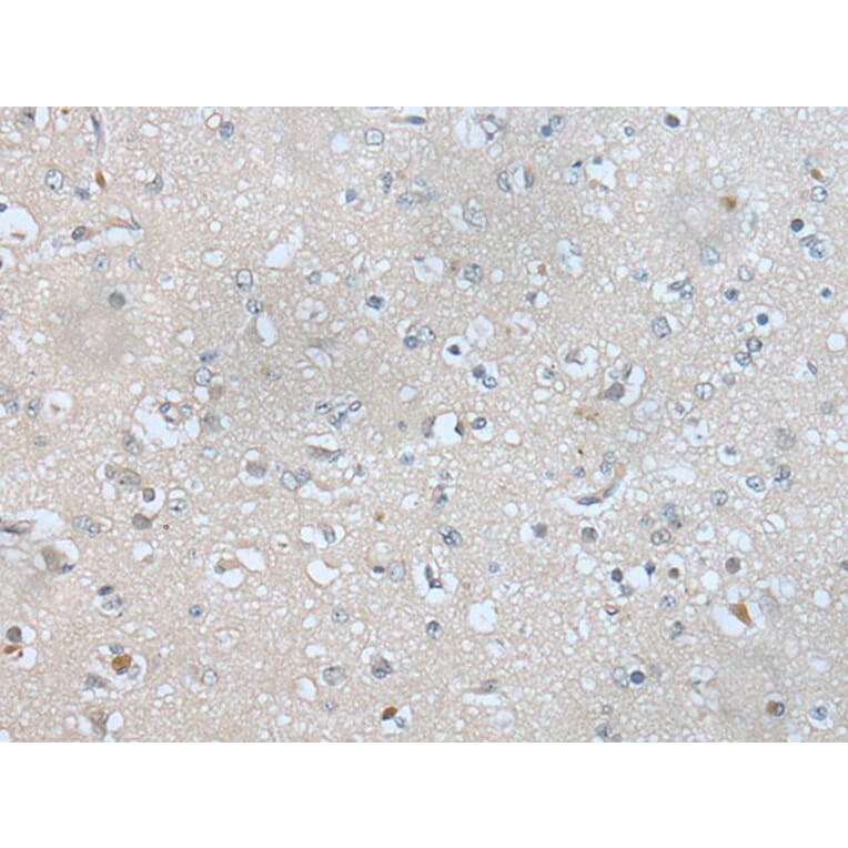 AK4 Antibody from Signalway Antibody (43922) - Antibodies.com