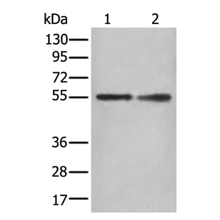 DES Antibody from Signalway Antibody (43938) - Antibodies.com