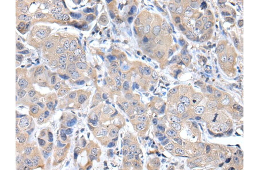 DES Antibody from Signalway Antibody (43938) - Antibodies.com