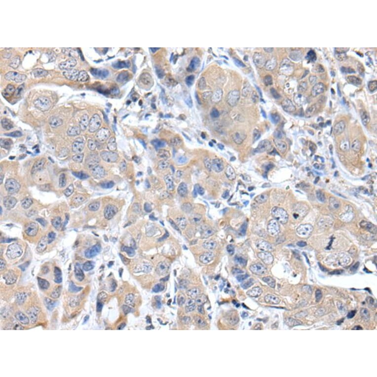 DES Antibody from Signalway Antibody (43938) - Antibodies.com