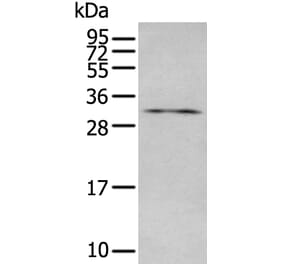 LAT Antibody from Signalway Antibody (43949) - Antibodies.com