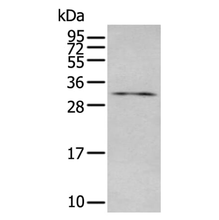 LAT Antibody from Signalway Antibody (43949) - Antibodies.com