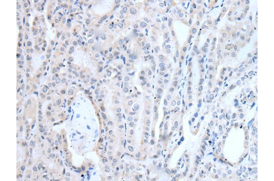 LAT Antibody from Signalway Antibody (43949) - Antibodies.com