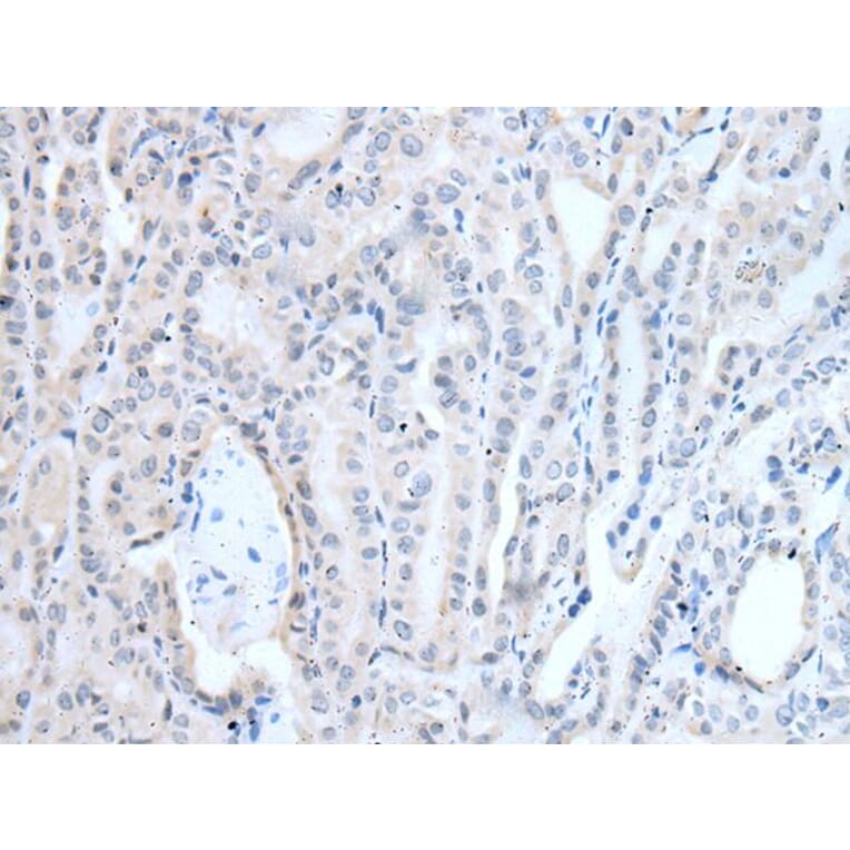 LAT Antibody from Signalway Antibody (43949) - Antibodies.com
