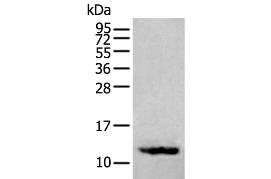 SST Antibody from Signalway Antibody (43957) - Antibodies.com