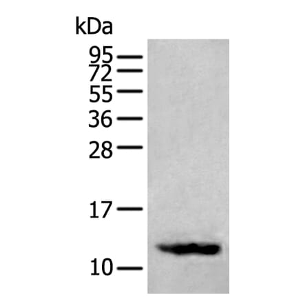 SST Antibody from Signalway Antibody (43957) - Antibodies.com