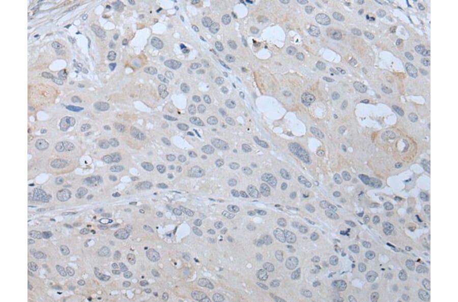 SST Antibody from Signalway Antibody (43957) - Antibodies.com