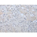 SST Antibody from Signalway Antibody (43957) - Antibodies.com