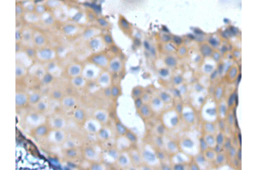NF1 Antibody from Signalway Antibody (43965) - Antibodies.com