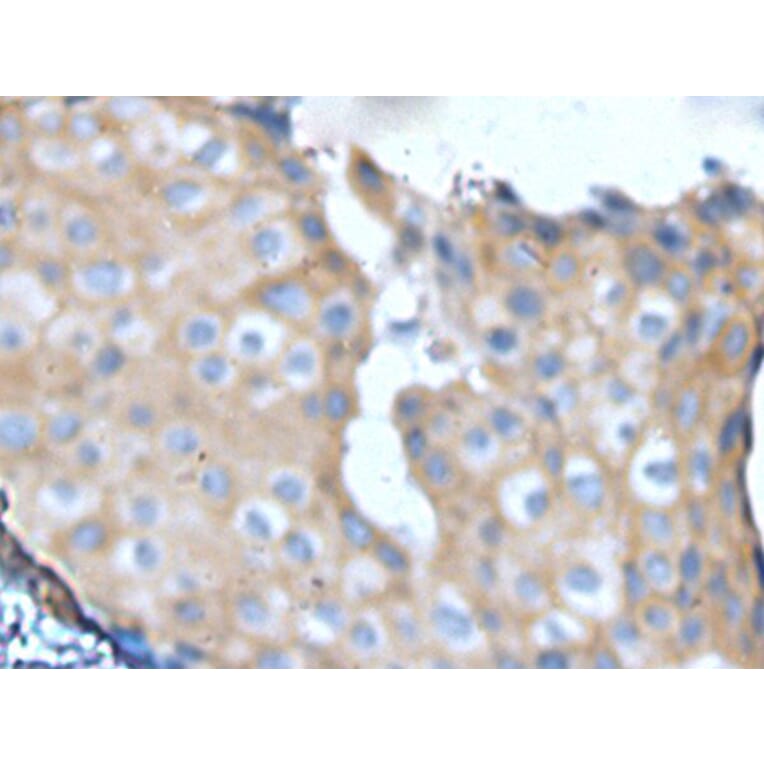 NF1 Antibody from Signalway Antibody (43965) - Antibodies.com