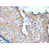 NF1 Antibody from Signalway Antibody (43965) - Antibodies.com