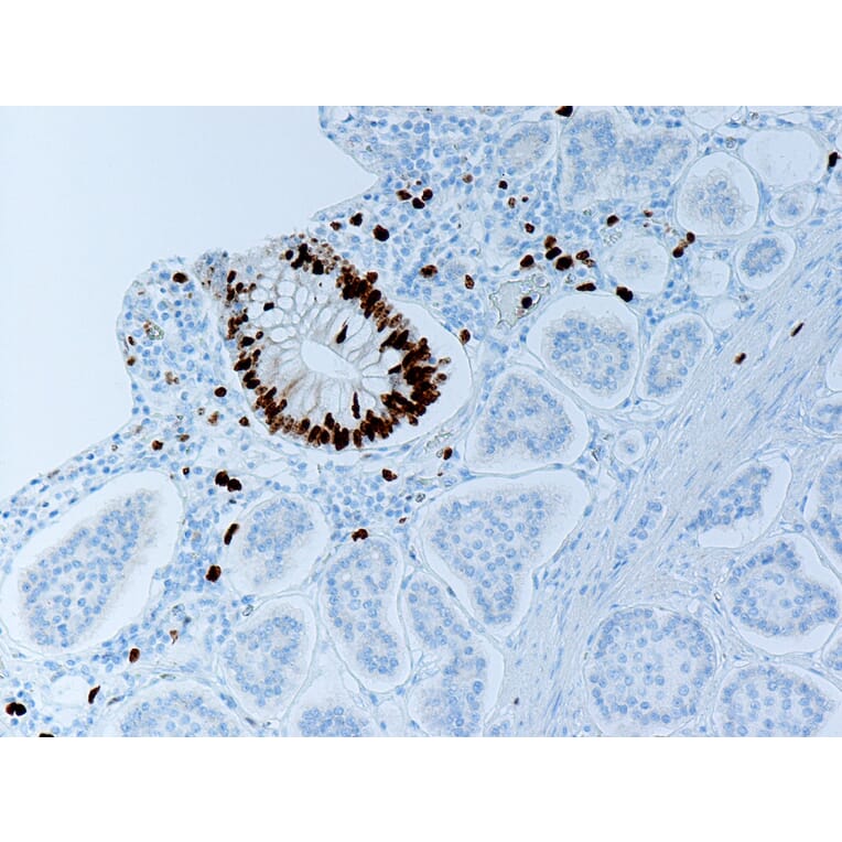 Ki67 Antibody from Signalway Antibody (29020) - Antibodies.com