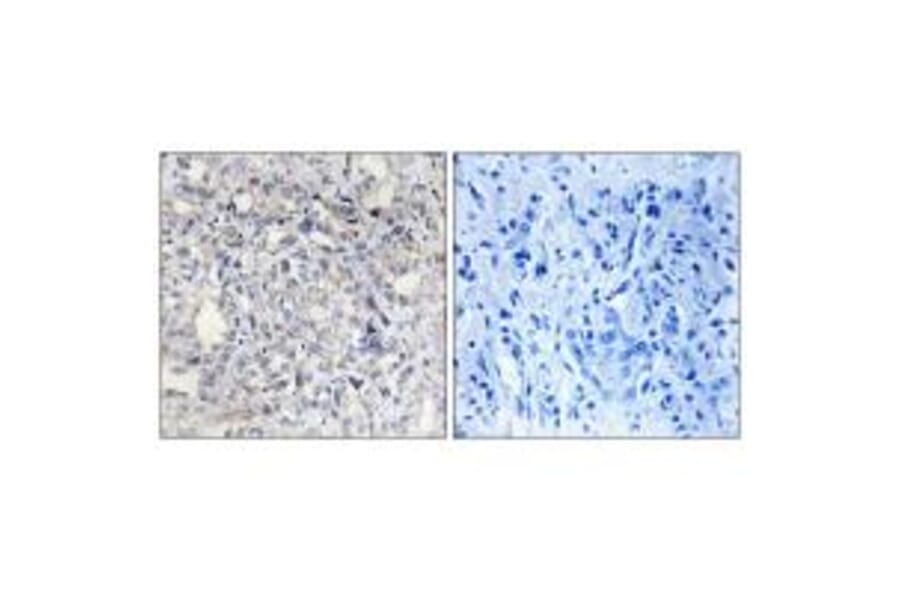 Immunohistochemistry - Heparin Cofactor II Antibody from Signalway Antibody (33652) - Antibodies.com