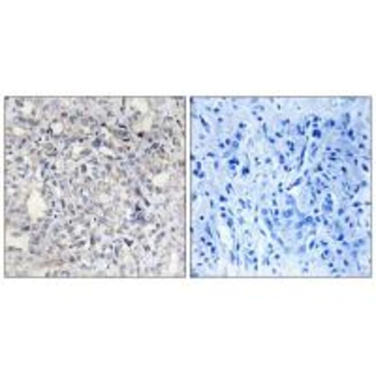 Immunohistochemistry - Heparin Cofactor II Antibody from Signalway Antibody (33652) - Antibodies.com