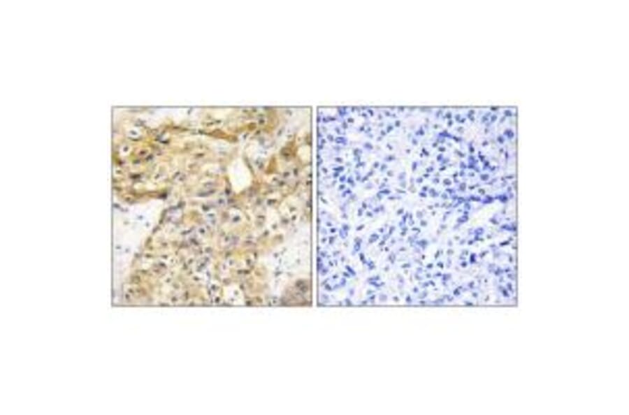 Immunohistochemistry - Collagen XVIII α1 Antibody from Signalway Antibody (34216) - Antibodies.com