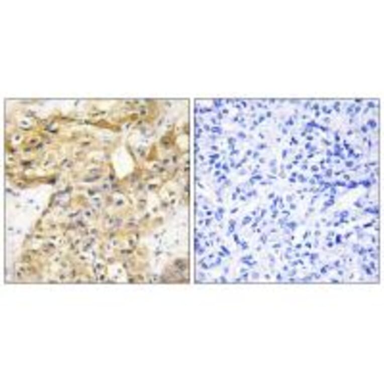 Immunohistochemistry - Collagen XVIII α1 Antibody from Signalway Antibody (34216) - Antibodies.com