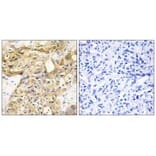 Immunohistochemistry - Collagen XVIII α1 Antibody from Signalway Antibody (34216) - Antibodies.com