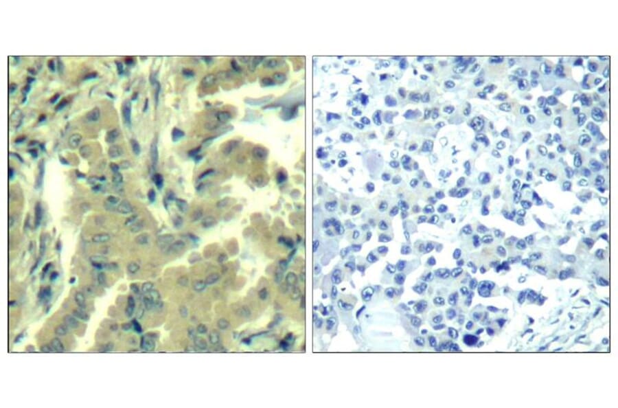 Immunohistochemistry - PLC-g2 (Ab-1217) Antibody from Signalway Antibody (21524) - Antibodies.com