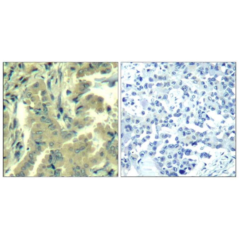 Immunohistochemistry - PLC-g2 (Ab-1217) Antibody from Signalway Antibody (21524) - Antibodies.com