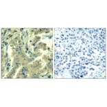 Immunohistochemistry - PLC-g2 (Ab-1217) Antibody from Signalway Antibody (21524) - Antibodies.com