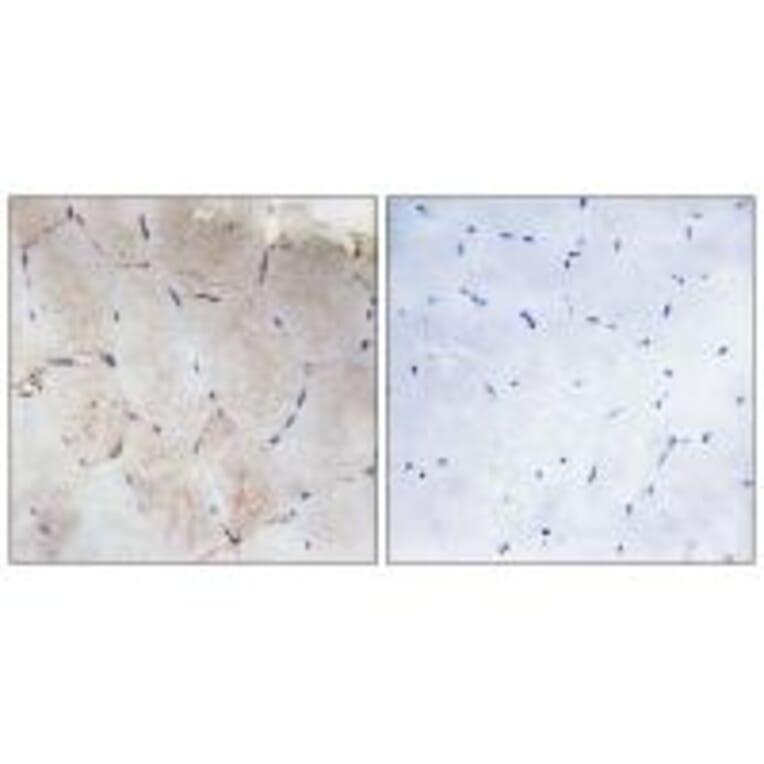 Immunohistochemistry - Collagen XII α1 Antibody from Signalway Antibody (34213) - Antibodies.com
