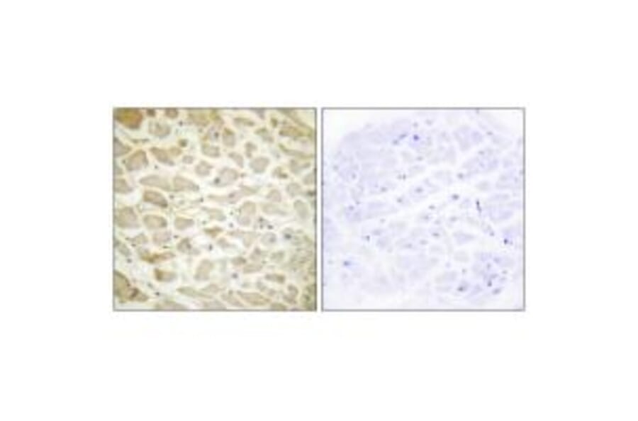 Immunohistochemistry - Collagen XIV α1 Antibody from Signalway Antibody (34214) - Antibodies.com