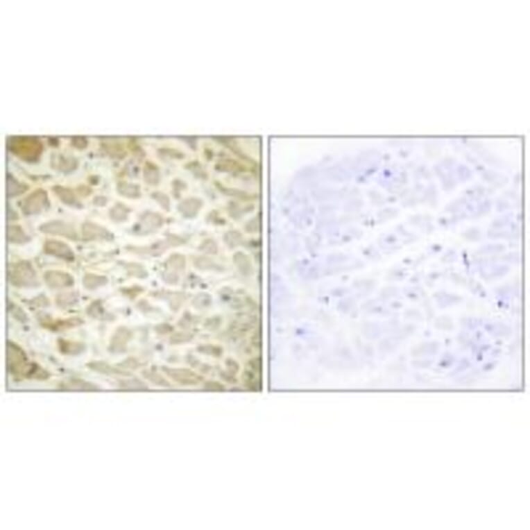 Immunohistochemistry - Collagen XIV α1 Antibody from Signalway Antibody (34214) - Antibodies.com