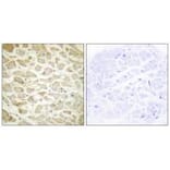 Immunohistochemistry - Collagen XIV α1 Antibody from Signalway Antibody (34214) - Antibodies.com