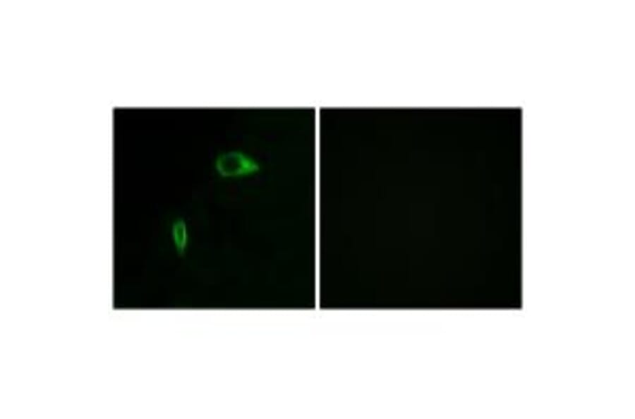 Immunofluorescence - Collagen XIV α1 Antibody from Signalway Antibody (34214) - Antibodies.com