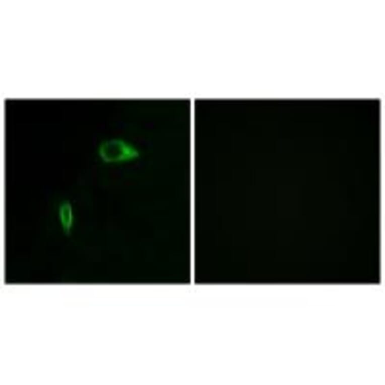 Immunofluorescence - Collagen XIV α1 Antibody from Signalway Antibody (34214) - Antibodies.com