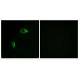 Immunofluorescence - Collagen XIV α1 Antibody from Signalway Antibody (34214) - Antibodies.com