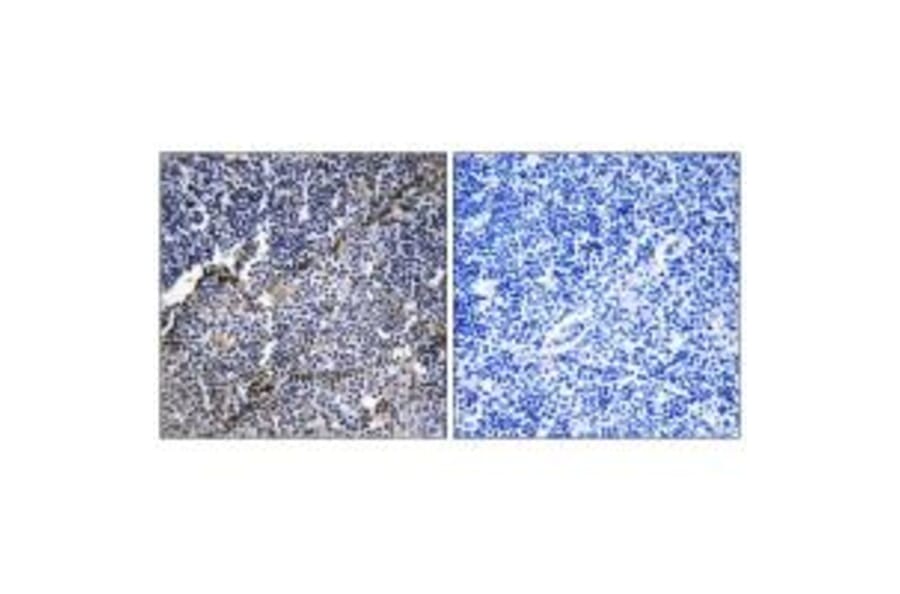 Immunohistochemistry - Collagen XIX α1 Antibody from Signalway Antibody (34217) - Antibodies.com