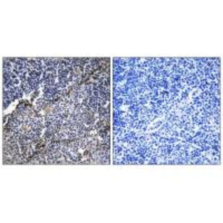 Immunohistochemistry - Collagen XIX α1 Antibody from Signalway Antibody (34217) - Antibodies.com