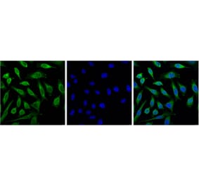 Progesterone Receptor Mouse Monoclonal Antibody (Z15) from Signalway Antibody (38096) - Antibodies.com