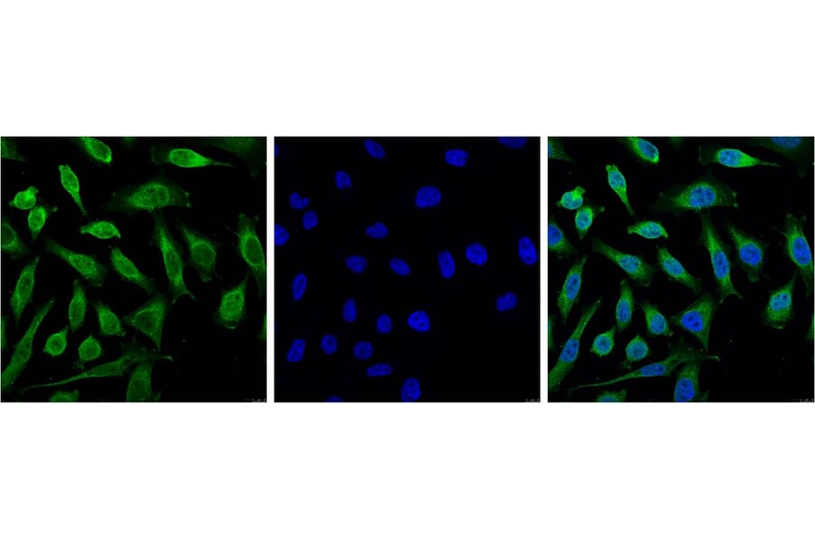 Progesterone Receptor Mouse Monoclonal Antibody (Z15) from Signalway Antibody (38096) - Antibodies.com