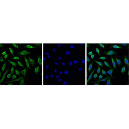 Progesterone Receptor Mouse Monoclonal Antibody (Z15) from Signalway Antibody (38096) - Antibodies.com