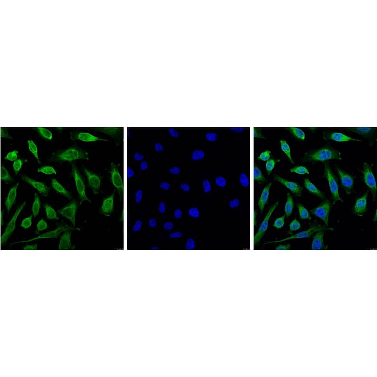 Progesterone Receptor Mouse Monoclonal Antibody (Z15) from Signalway Antibody (38096) - Antibodies.com