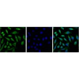 Progesterone Receptor Mouse Monoclonal Antibody (Z15) from Signalway Antibody (38096) - Antibodies.com