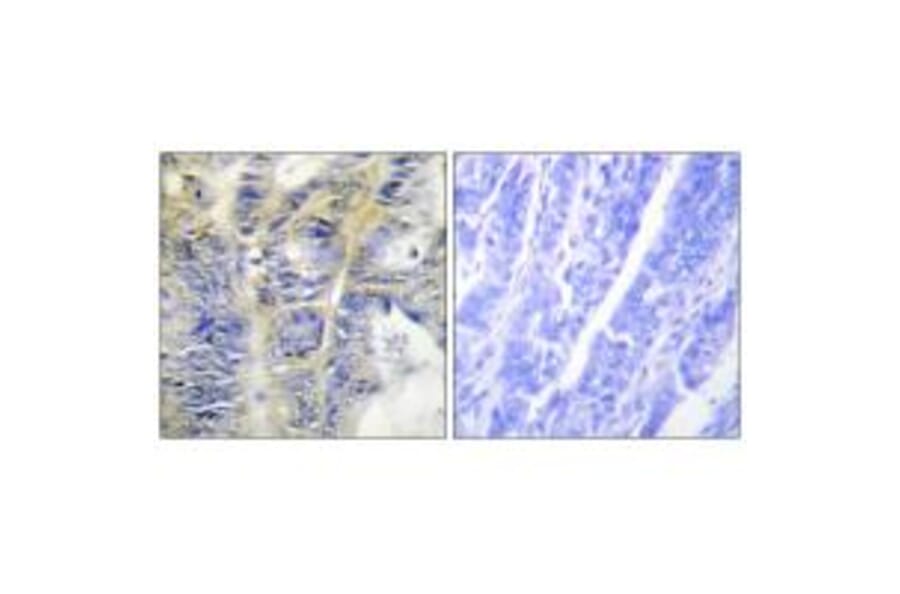 Immunohistochemistry - Collagen IV α5 Antibody from Signalway Antibody (34204) - Antibodies.com