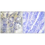 Immunohistochemistry - Collagen IV α5 Antibody from Signalway Antibody (34204) - Antibodies.com